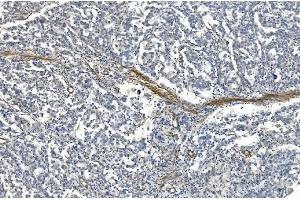 IHC analysis of Filamin A/FLNA using anti-Filamin A/FLNA antibody (ABIN7601783). (Filamin A anticorps  (AA 451-638))