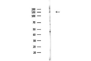 Western blot analysis of lysates from HepG2 cells(starvation,24h treatment), using BCL9 Antibody at 1/1000 dilution.