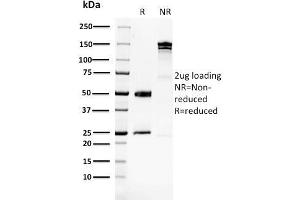 SDS-PAGE Analysis Purified GPI Mouse Monoclonal Antibody (CPTC-GPI-1). (GPI anticorps)