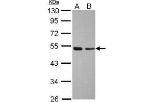 WB Image Sample (30 ug of whole cell lysate) A: A431 B: Jurkat 10% SDS PAGE antibody diluted at 1:1000 (TAF7 anticorps  (Center))