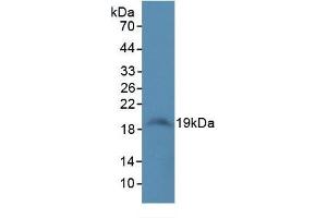 WB of Protein Standard: different control antibody against Highly purified E. (SOD1 Kit ELISA)