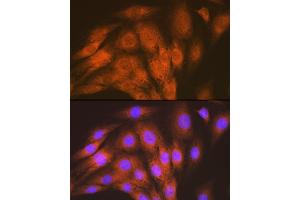Immunofluorescence analysis of C6 cells using  Rabbit mAb (ABIN7265412) at dilution of 1:100 (40x lens).