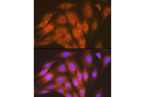 Immunofluorescence analysis of C6 cells using  Rabbit mAb (ABIN7265412) at dilution of 1:100 (40x lens). (ACVRL1 anticorps)