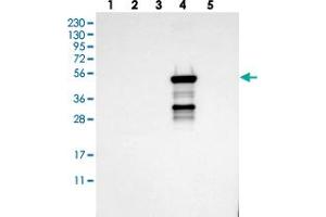 Western blot analysis of Lane 1: RT-4, Lane 2: U-251 MG, Lane 3: Human Plasma, Lane 4: Liver, Lane 5: Tonsil with CYP2C19 polyclonal antibody . (CYP2C9 anticorps)