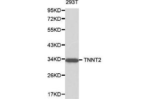 Western blot analysis of 293T cell lysate using TNNT2 antibody. (Cardiac Troponin T2 anticorps  (AA 1-120))