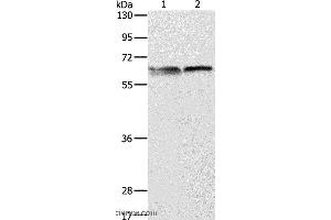 Western blot analysis of 293T and Jurkat cell, using ALAS2 Polyclonal Antibody at dilution of 1:1000 (ALAS2 anticorps)