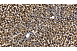 Detection of TICAM1 in Mouse Liver Tissue using Polyclonal Antibody to Toll Like Receptor Adaptor Molecule 1 (TICAM1)