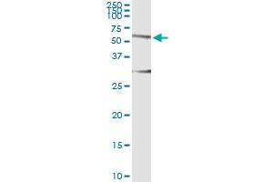 Immunoprecipitation of HERPUD1 transfected lysate using anti-HERPUD1 monoclonal antibody and Protein A Magnetic Bead , and immunoblotted with HERPUD1 MaxPab rabbit polyclonal antibody.