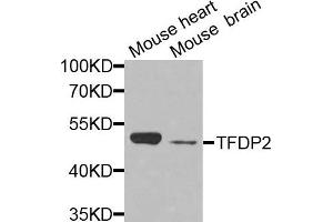Western blot analysis of extracts of mouse heart and mouse brain cells, using TFDP2 antibody.