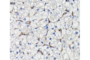 Immunohistochemistry of paraffin-embedded Human liver using COMP Polyclonal Antibody at dilution of 1:100 (40x lens). (COMP anticorps)