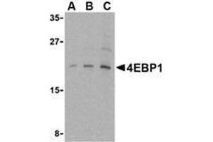 Western blot analysis of AP30001PU-N 4E-BP1 antibody in 3T3 cell lysate with 4E-BP1 antibody at (A) 2. (eIF4EBP1 anticorps  (C-Term))