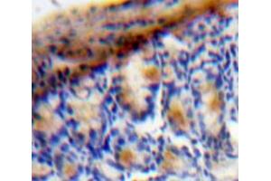Used in DAB staining on fromalin fixed paraffin-embedded Bowels tissue (VEGFC anticorps  (AA 47-413))