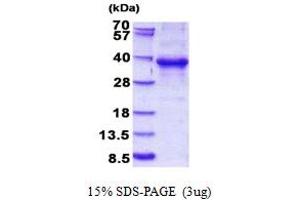 SDS-PAGE (SDS) image for Ets Homologous Factor (EHF) (AA 1-300) protein (His tag) (ABIN5852935)