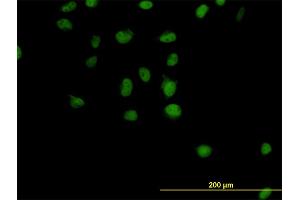 Immunofluorescence of monoclonal antibody to CSE1L on HeLa cell. (Exportin 2 anticorps  (AA 872-971))