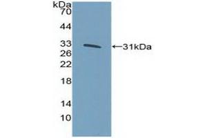 Detection of Recombinant KLF5, Human using Polyclonal Antibody to Kruppel Like Factor 5, Intestinal (KLF5) (KLF5 anticorps  (AA 216-457))