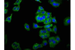 Immunofluorescence staining of HepG2 cells with ABIN7161195 at 1:266, counter-stained with DAPI.