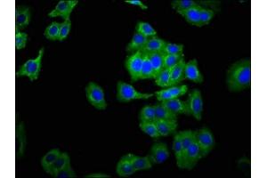 Immunofluorescence staining of HepG2 cells with ABIN7161195 at 1:266, counter-stained with DAPI. (NCAM2 anticorps  (AA 209-333))