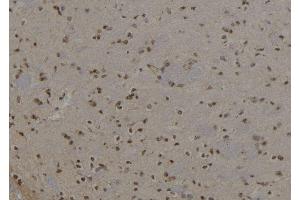 ABIN6277960 at 1/100 staining Rat brain tissue by IHC-P. (KRT6A anticorps  (N-Term))
