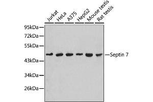 Western blot analysis of extracts of various cell lines, using Septin 7 antibody (ABIN1682655, ABIN3018092, ABIN3018093 and ABIN6220357). (7-Sep (AA 307-436) anticorps)