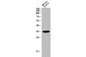 Western Blot analysis of MOUSE-BRAIN cells using IGFBP3 Polyclonal Antibody (IGFBP3 anticorps  (Ser183))