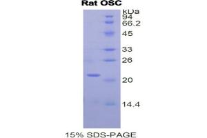 SDS-PAGE analysis of Rat Oxidosqualene Cyclase Protein.