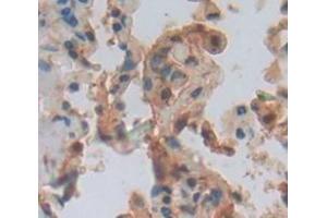 IHC-P analysis of Human Tissue, with DAB staining. (ARHGDIB anticorps  (AA 2-201))