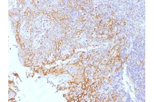 Formalin-fixed, paraffin-embedded human Tonsil stained with Beta-Catenin (p120) Monoclonal Antibody (5H10).