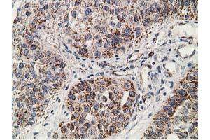 Image no. 6 for anti-Synovial Sarcoma, X Breakpoint 1 (SSX1) antibody (ABIN1501156) (SSX1 anticorps)
