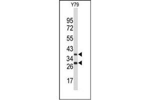 Western blot analysis of FBXO4 Antibody (Center) in Y79 cell line lysates (35ug/lane). (FBXO4 anticorps  (Middle Region))