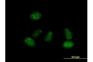 Immunofluorescence of purified MaxPab antibody to ALS2CR15 on HeLa cell. (ICA1L anticorps  (AA 1-482))