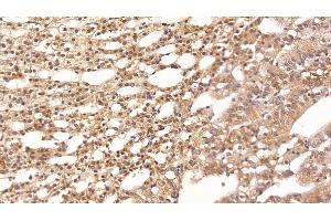 Detection of CLU in Rabbit Adrenal gland Tissue using Monoclonal Antibody to Clusterin (CLU)