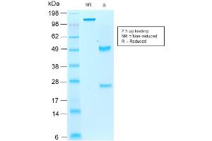 SDS-PAGE Analysis of Purified AIF1/IBA1 Mouse Recombinant Monoclonal Antibody ABIN6383787. (Recombinant Iba1 anticorps)