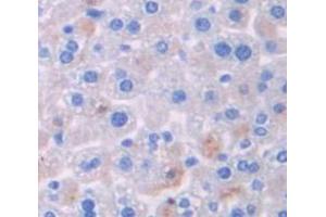 IHC-P analysis of Mouse Tissue, with DAB staining. (TXK anticorps  (AA 286-509))