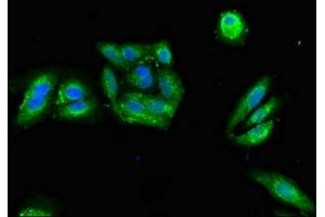 Immunofluorescent analysis of HepG2 cells using ABIN7146620 at dilution of 1:100 and Alexa Fluor 488-congugated AffiniPure Goat Anti-Rabbit IgG(H+L)