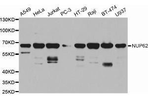 Western blot analysis of extracts of various cell lines, using NUP62 antibody (ABIN5971334) at 1/1000 dilution. (NUP62 anticorps)