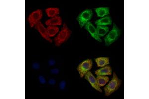 ABIN6260562 and ABIN6272683 staining Hela cells by IF/ICC. (CCR8 anticorps  (C-Term))