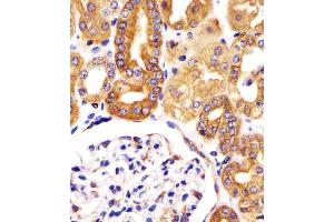 (ABIN6244121 and ABIN6578389) staining VAC14 in human kidney tissue sections by Immunohistochemistry (IHC-P - paraformaldehyde-fixed, paraffin-embedded sections). (VAC14 anticorps  (AA 125-159))