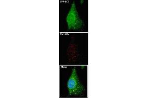 Immunofluorescence (IF) image for anti-Microtubule-Associated Protein 1 Light Chain 3 alpha (MAP1LC3A) antibody (ABIN5551132)