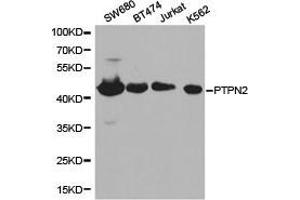 Western Blotting (WB) image for anti-Protein tyrosine Phosphatase, Non-Receptor Type 2 (PTPN2) antibody (ABIN1874450) (PTPN2 anticorps)