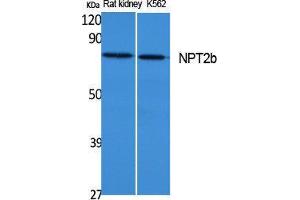Western Blotting (WB) image for anti-Solute Carrier Family 34 (Sodium Phosphate), Member 2 (SLC34A2) (C-Term) antibody (ABIN3187660) (SLC34A2 anticorps  (C-Term))
