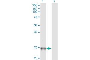 Western Blot analysis of RAB1B expression in transfected 293T cell line by RAB1B monoclonal antibody (M02), clone 1B2.