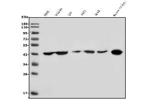 Western blot analysis of HOXD11 using anti-HOXD11 antibody (ABIN7603174).