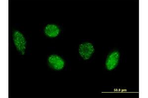 Immunofluorescence of purified MaxPab antibody to VIM on HeLa cell. (Vimentin anticorps  (AA 1-466))