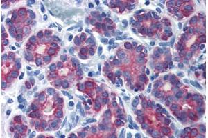 Human Breast (formalin-fixed, paraffin-embedded) stained with KRT7 antibody ABIN337389 at 10 ug/ml followed by biotinylated goat anti-rabbit IgG secondary antibody ABIN481713, alkaline phosphatase-streptavidin and chromogen. (Cytokeratin 7 anticorps  (N-Term))