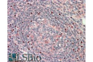 ABIN940552 (5µg/ml) staining of paraffin embedded Human Tonsil. (CTDSP1 anticorps  (Internal Region))
