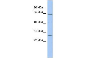 WB Suggested Anti-FAM71B Antibody Titration: 0. (FAM71B anticorps  (Middle Region))