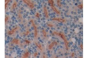 anti-Meprin A, beta (MEP1B) (AA 433-679) antibody