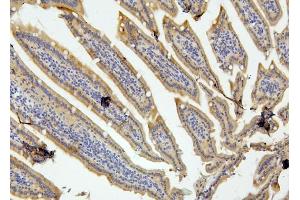 IHC analysis of RET using anti-RET antibody (ABIN6719502). (Ret Proto-Oncogene anticorps  (AA 29-304))