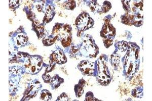 Formalin-fixed, paraffin-embedded human placenta stained with CD34 antibody (QBEnd/10 + HPCA1/763) (CD34 anticorps)