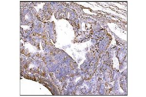 IHC analysis of NDEL1 using anti-NDEL1 antibody (ABIN7602511). (NDEL1 anticorps  (AA 80-320))